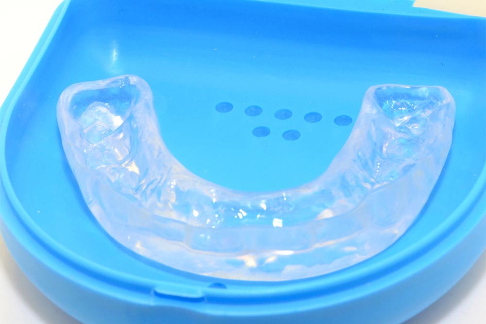 Pre-orthodontic dental trainer alignment appliance