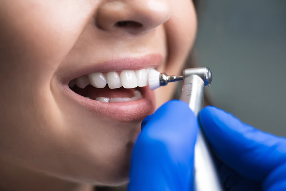 A woman having her teeth whitened