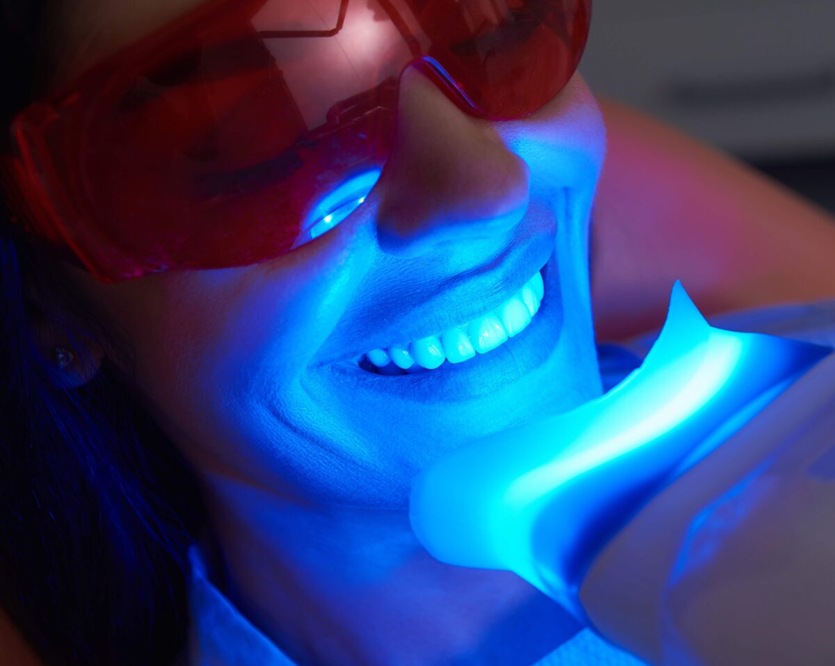 Professional Teeth Whitening in Estero, FL