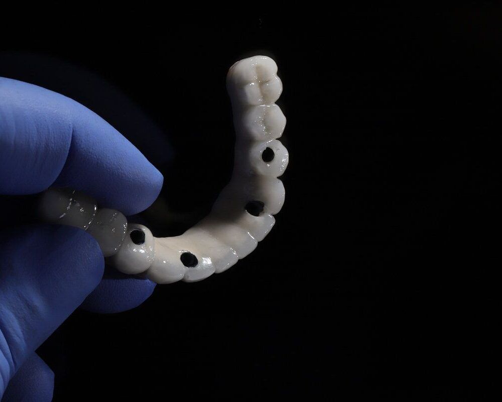 Gloved hand holding a full arch dental bridge model
